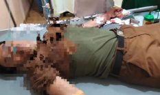 Heboh Pegawai Dinas PU Kota Metro Ditemukan Kritis di Kantor